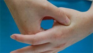 hand points for headache