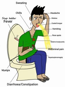 constipation/diarrhoea