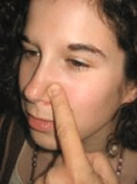 Nostril Point for Stuffy Nose